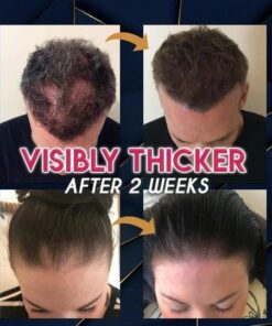 Pure Grow תמצית צמיחת שיער