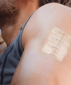 פלסטר פצע הידוק ללא מחטים