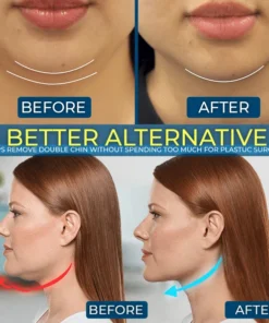 מגדיר הלסת V-Lab