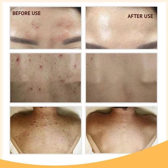 סט רטינול C+ Brightening Serum - Image 10