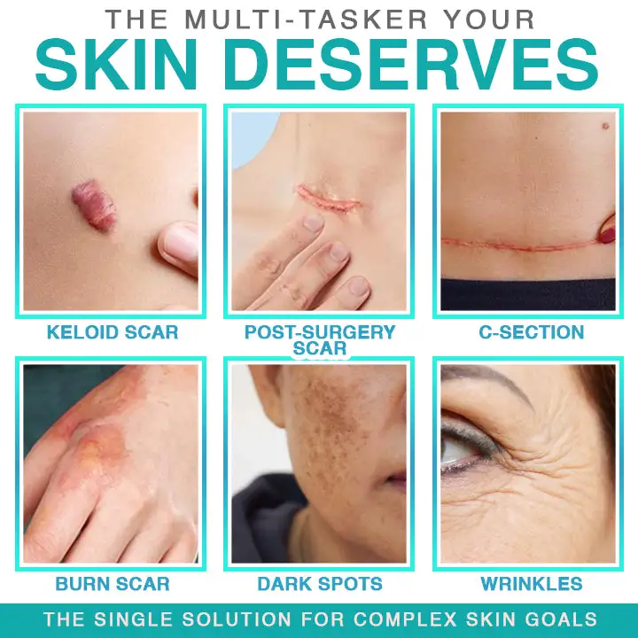 ๐๐ฎ๐ฟ๐ฒ๐๐ฟ๐ฒ๐ฒ๐๐ฒยฎ 3-in-1 Microneedle Care Patch - Image 2