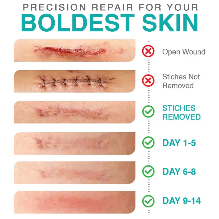 ๐๐ฎ๐ฟ๐ฒ๐๐ฟ๐ฒ๐ฒ๐๐ฒยฎ 3-in-1 Microneedle Care Patch - Image 4