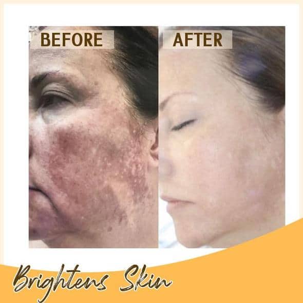 סט רטינול C+ Brightening Serum - Image 6