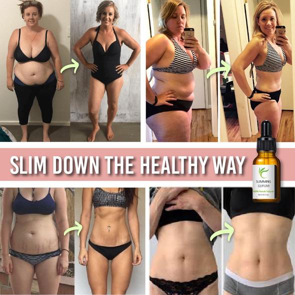 חגורת מתיחת בטן עם סרום שריפת שומן - Image 6