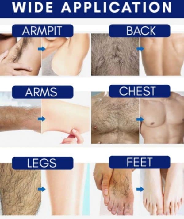 קרם להסרת זקן לצמיתות - Image 6