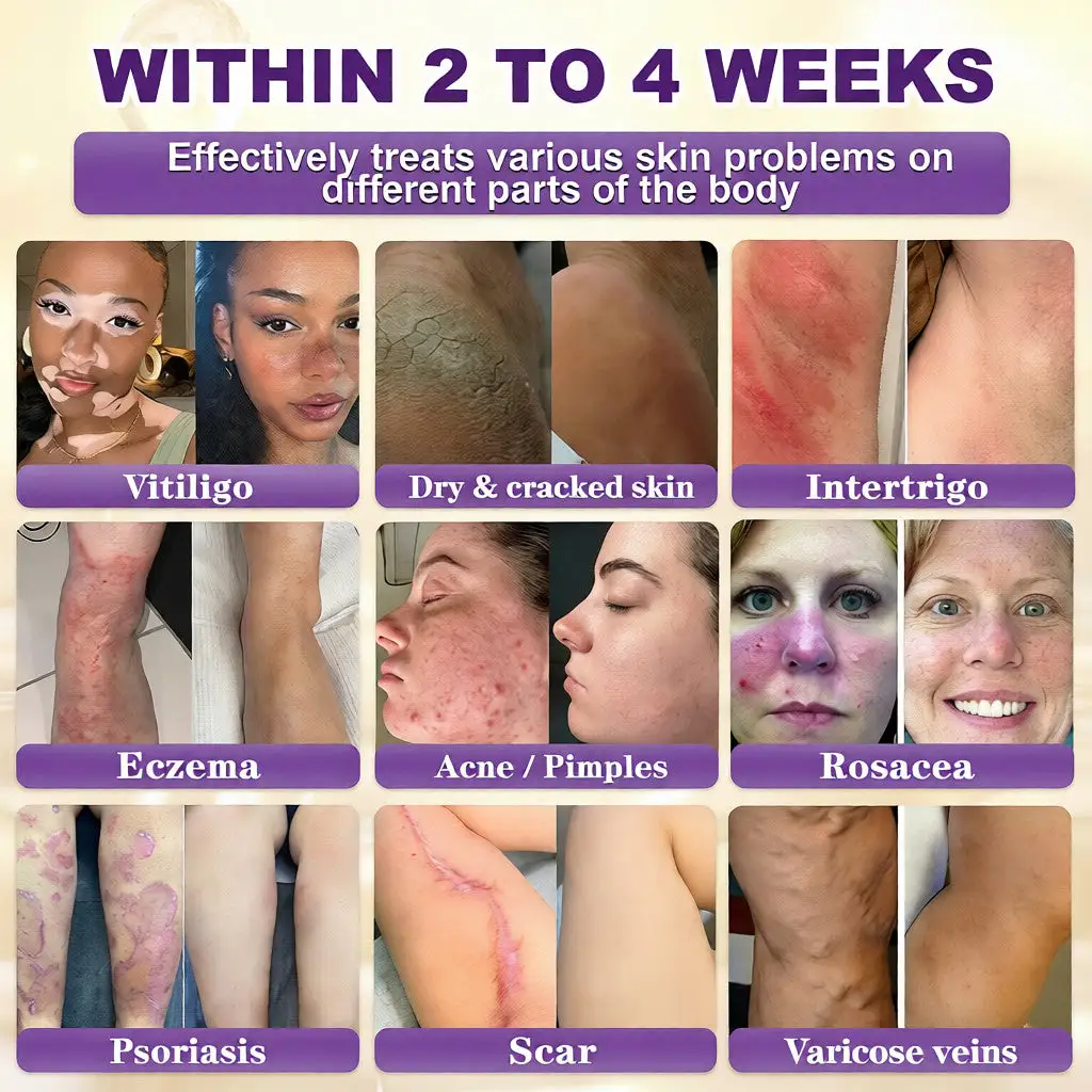 Acezozla® Biotin 10-in-1 קרם שיקום העור - Image 2