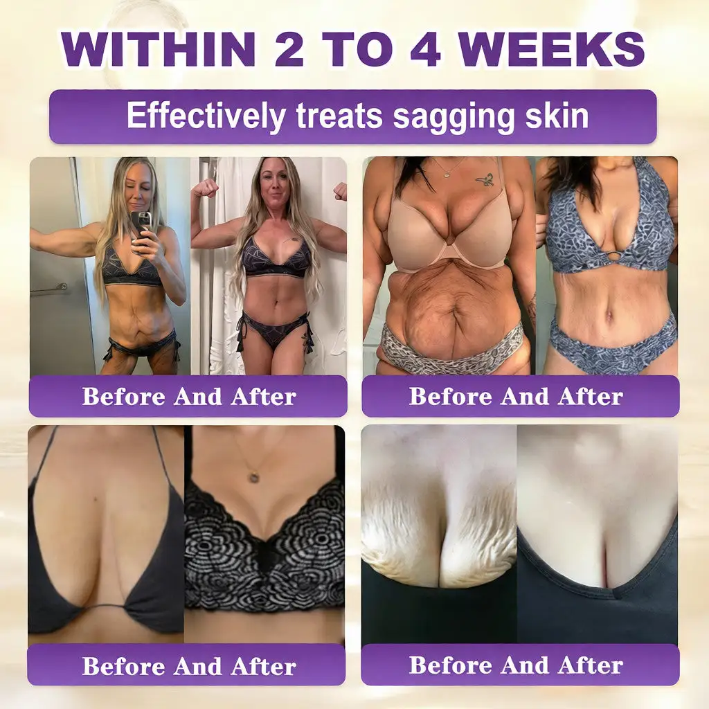 Acezozla® Biotin 10-in-1 קרם שיקום העור - Image 3