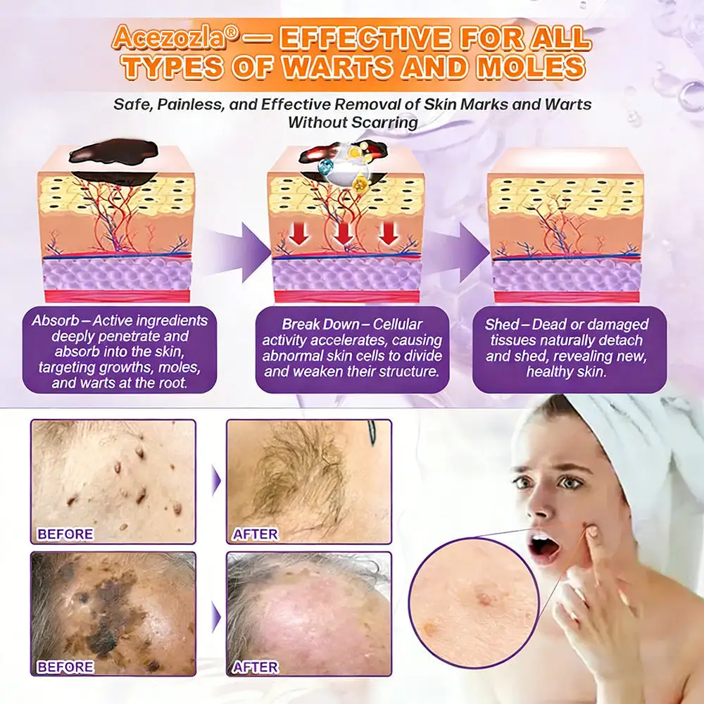 Acezozla® Biotin 10-in-1 קרם שיקום העור - Image 9