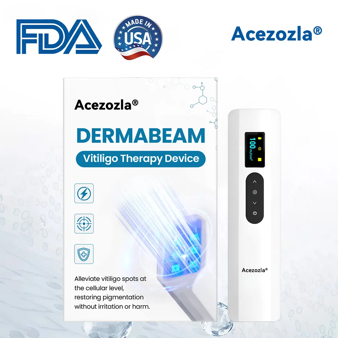 Acezozla® DermaBeam ויטיליגו מכשיר לטיפול