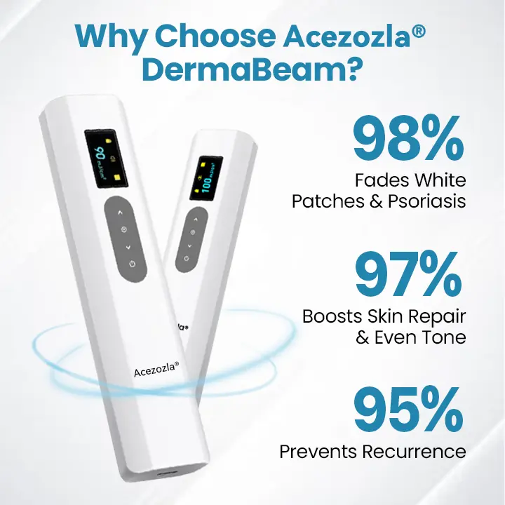 Acezozla® DermaBeam ויטיליגו מכשיר לטיפול - Image 6