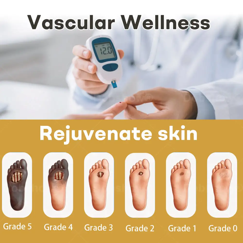 Acezozla® GlucoShield Bee Venom Wound Spray - Image 2