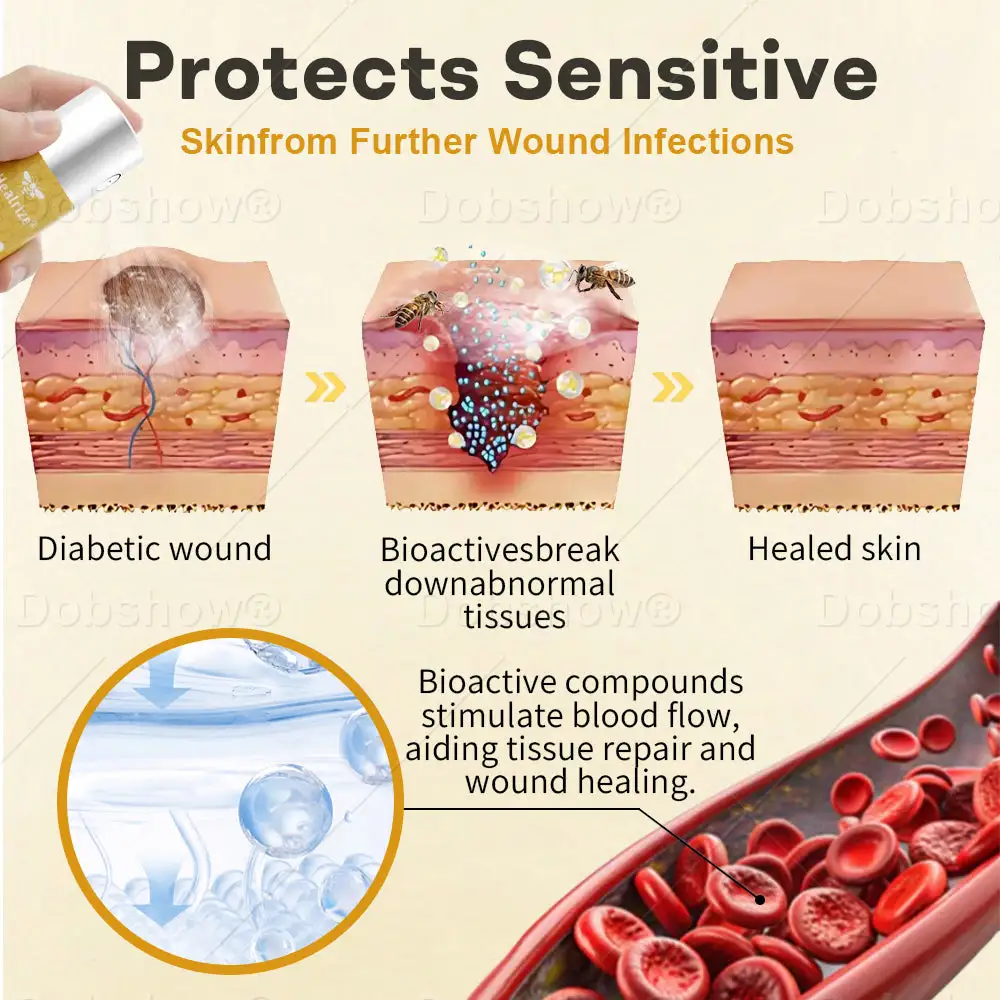 Acezozla® GlucoShield Bee Venom Wound Spray - Image 3