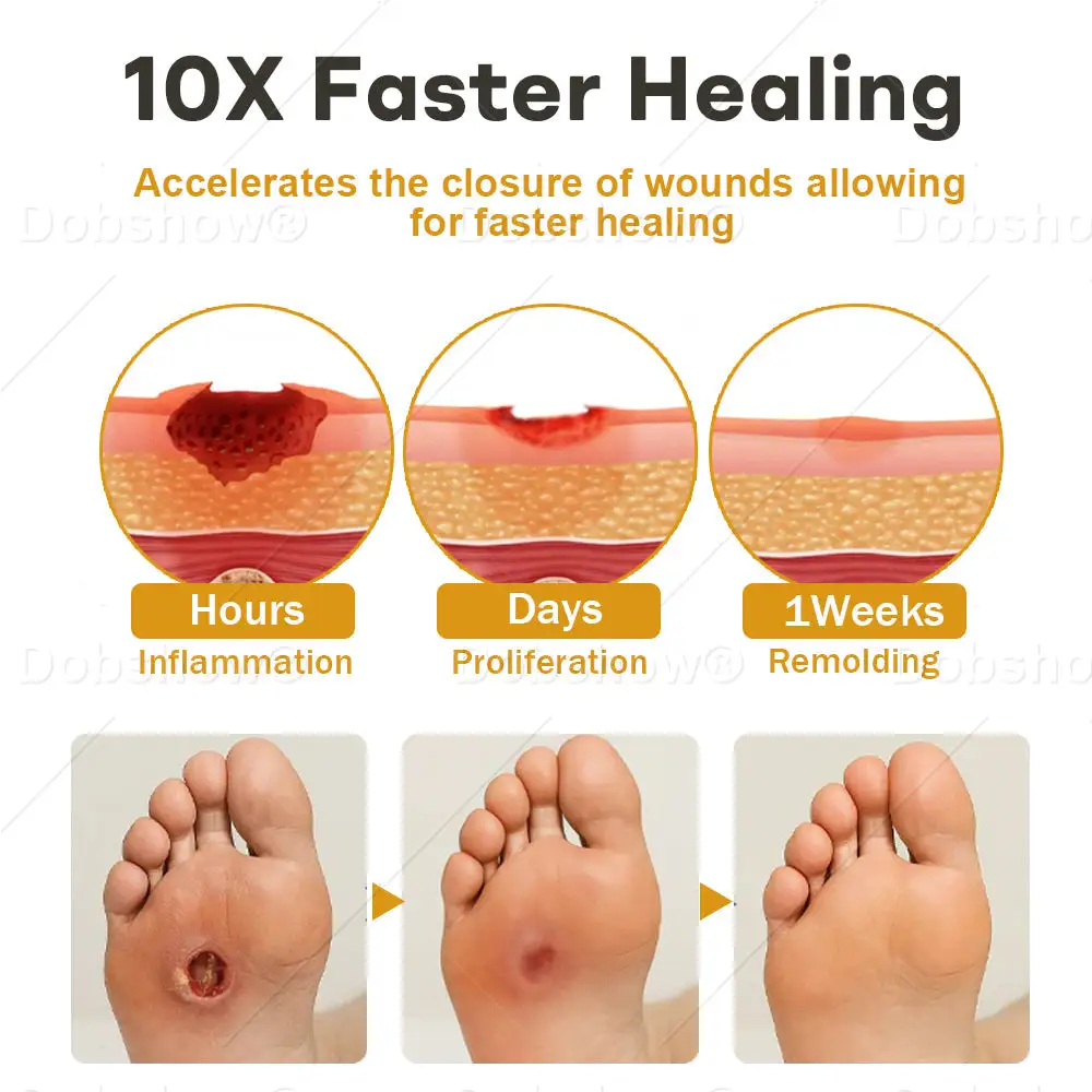 Acezozla® GlucoShield Bee Venom Wound Spray - Image 4