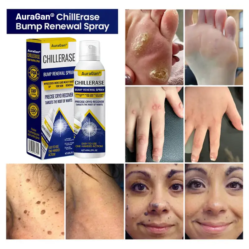 AuraGan® ChillErase תרסיס לחידוש בליטות - Image 4