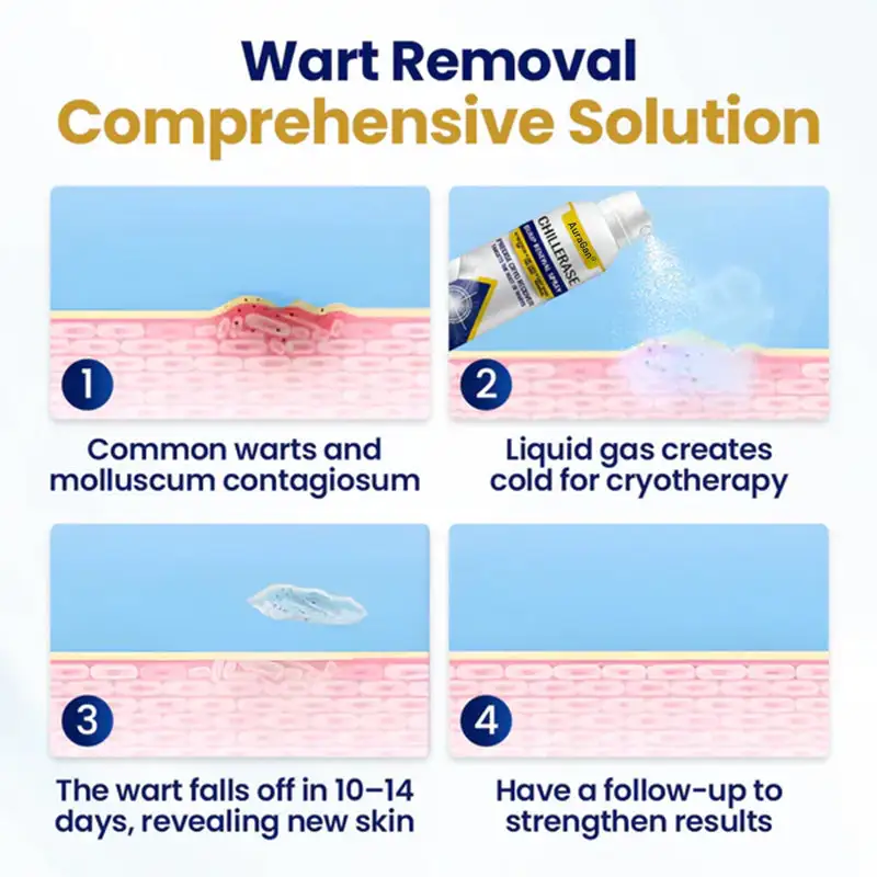 AuraGan® ChillErase תרסיס לחידוש בליטות - Image 6