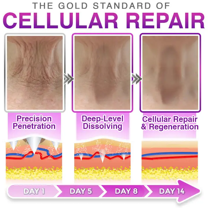 CareBreeze® 3-in-1 תיקון אנטי אייג'ינג מסוג Microneedle - Image 3