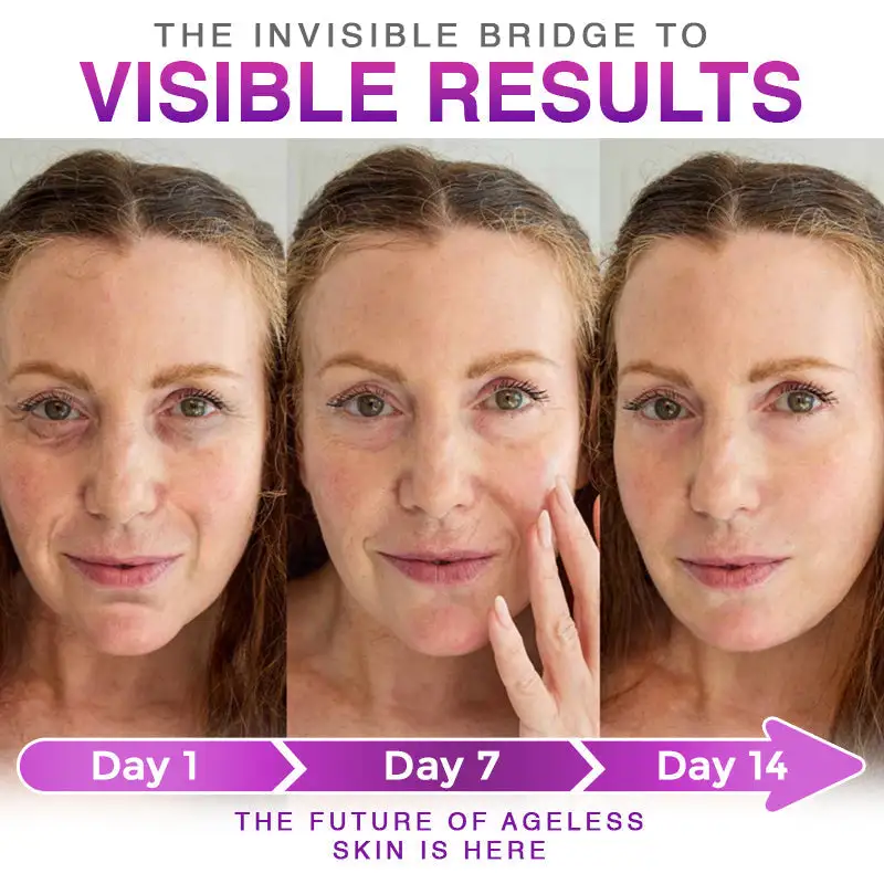 CareBreeze® 3-in-1 תיקון אנטי אייג'ינג מסוג Microneedle - Image 5