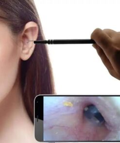 אנדוסקופ מצלמת איסוף אוזניים