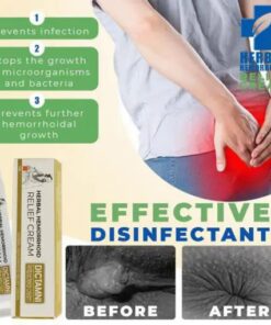 משחה לטיפול בטחורים