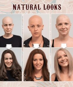 סרט פאה חזיתי תחרה (36 יחידות)