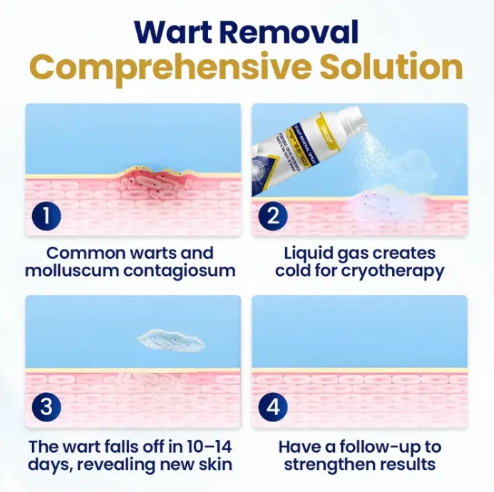 תרסיס לחידוש בליטות של Yagoo® Chillique - Image 3