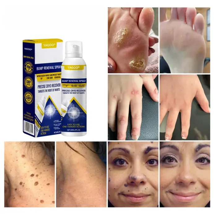 תרסיס לחידוש בליטות של Yagoo® Chillique - Image 5